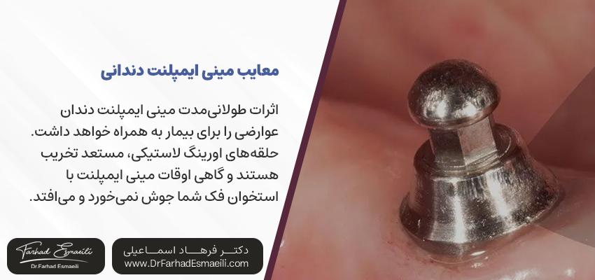 معایب مینی ایمپلنتهای دندانی | بهترین متخصص ایمپلنت اصفهان