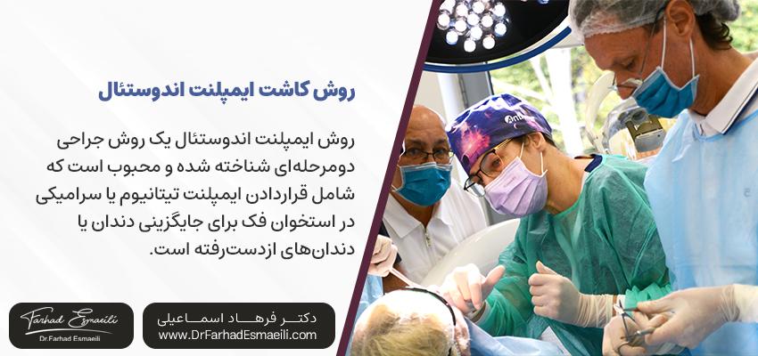 روش‌ کاشت ایمپلنت اندوستال چیست؟ | دکتر فرهاد اسماعیلی