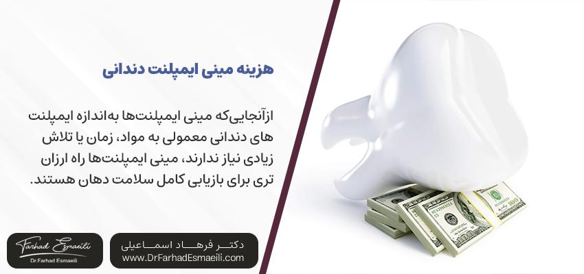 مینی ایمپلنت دندان چقدر هزینه دارد؟ | دکتر فرهاد اسماعیلی