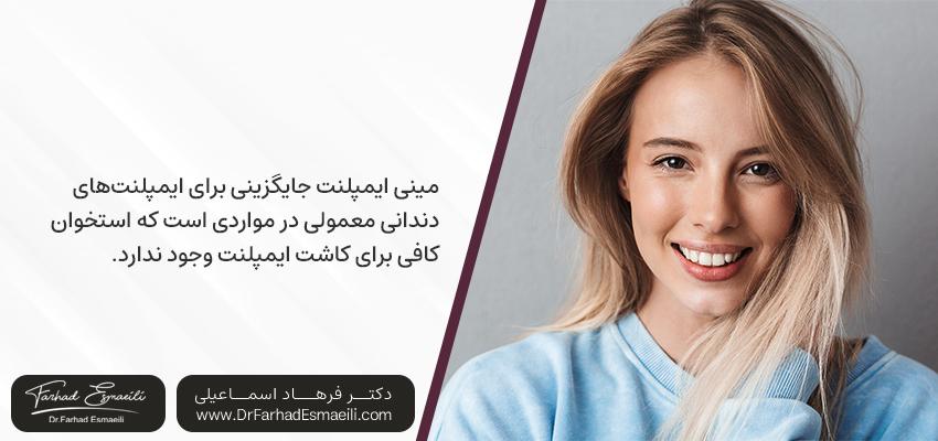 چه کسانی میتوانند از مینی ایمپلنت استفاده کنند؟ | دکتر فرهاد اسماعیلی