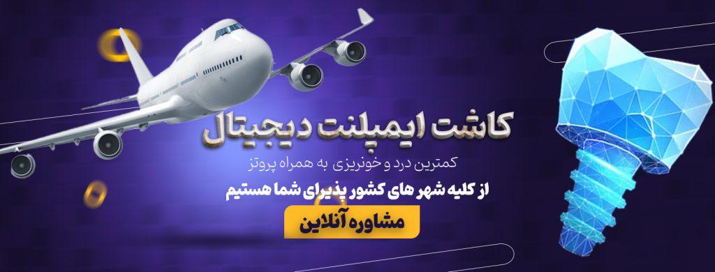 مشاوره آنلاین کاشت ایمپلنت دیجیتال در اصفهان و کل ایران