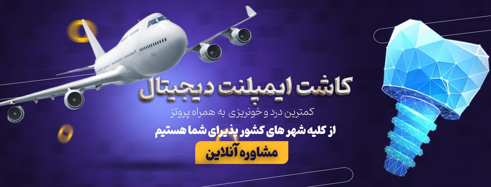 مشاوره آنلاین کاشت ایمپلنت دیجیتال در اصفهان و کل ایران