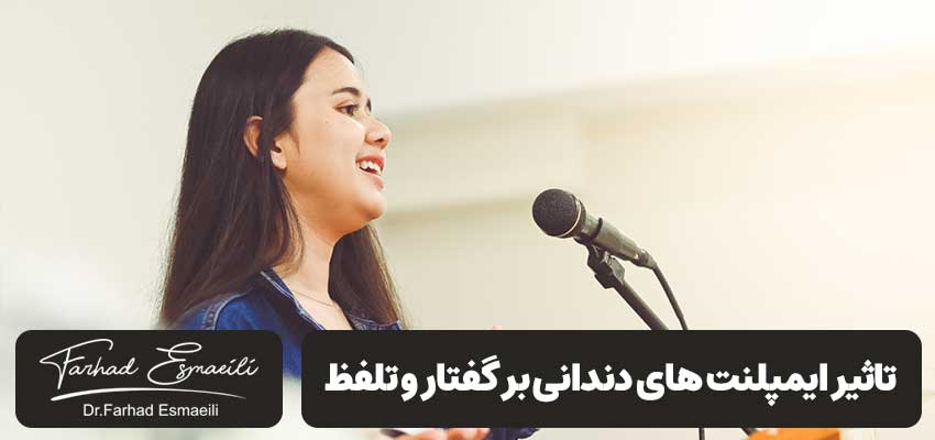 تاثیر ایمپلنت های دندانی بر گفتار و تلفظ | دکتر فرهاد اسماعیلی