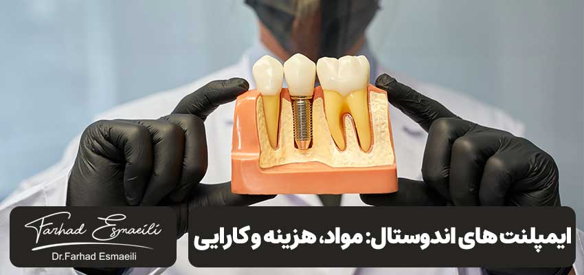 ایمپلنت های اندوستال: مواد، هزینه و کارایی | دکتر فرهاد اسماعیلی