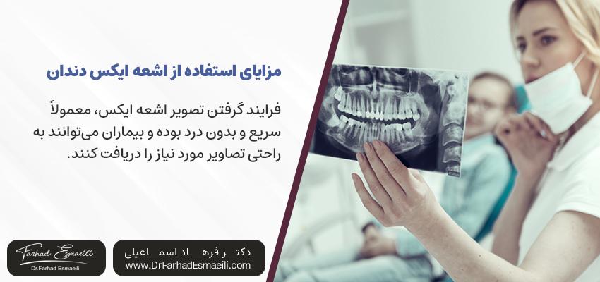مزایای استفاده از اشعه ایکس دندان | ایمپلنت دیجیتال اصفهان