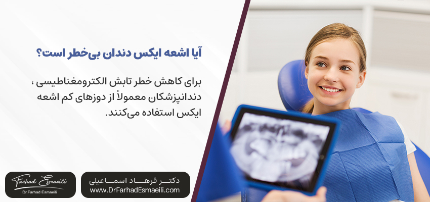 آیا اشعه ایکس دندان بی‌خطر است؟ | بهترین متخصص دندانپزشکی زیبایی اصفهان