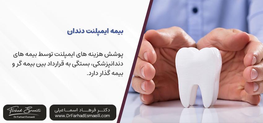همیشه ایمپلنتها تحت پوشش بیمه نیستند؟ | دکتر فرهاد اسماعیلی در اصفهان