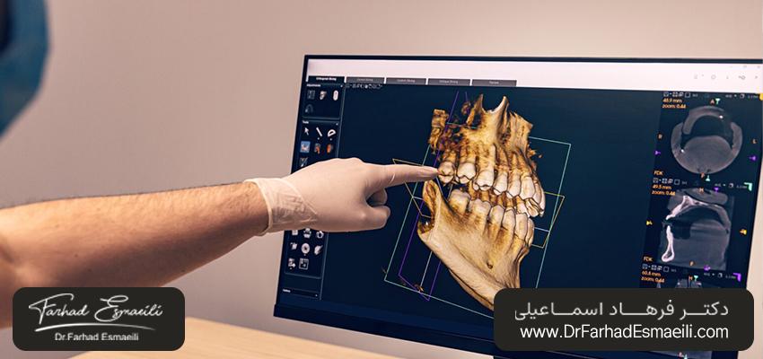 اشعه ایکس سه‌بعدی دندان | دندانپزشکی زیبایی اصفهان