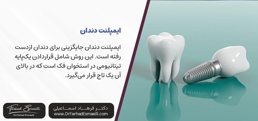 ایمپلنت دندان چیست؟ دکتر فرهاد اسماعیلی