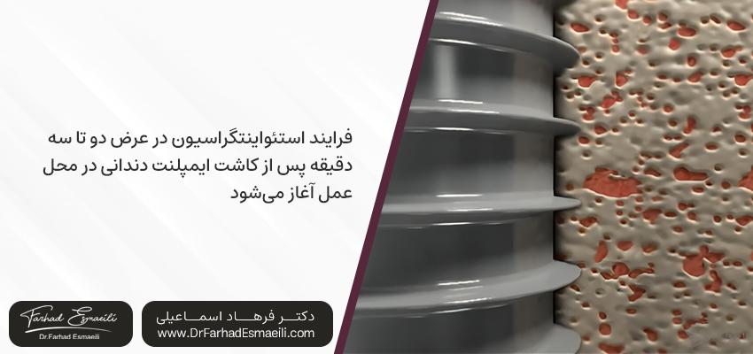 استئواینتگراسیون در ایمپلنت های دندانی چگونه عمل می کند؟ | دکتر فرهاد اسماعیلی در اصفهان