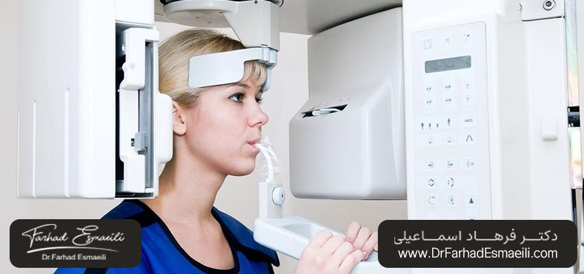 عکس‌برداری با اشعه ایکس دندان چگونه انجام می‌شود؟ | دکتر فرهاد اسماعیلی در اصفهان