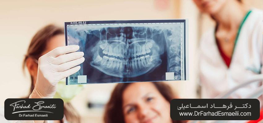 هر چند وقت یک‌بار باید اشعه ایکس دندان بگیرم؟ | دکتر فرهاد اسماعیلی در اصفهان