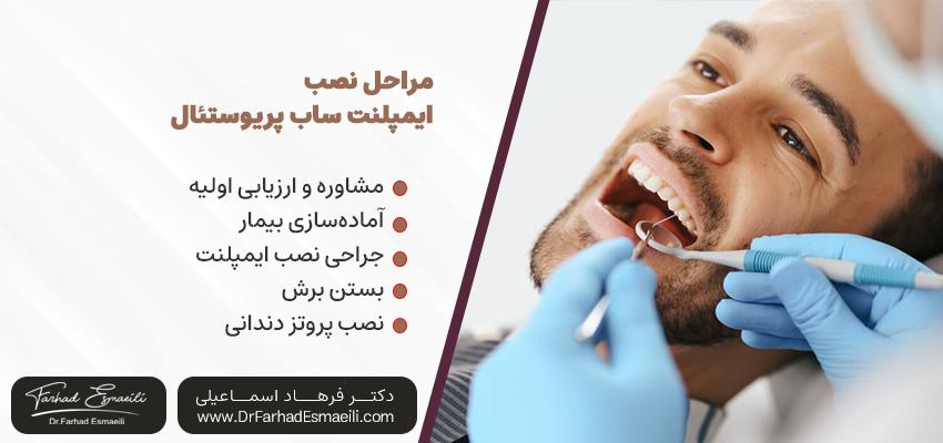 مراحل نصب ایمپلنت‌های ساب پریوستئال | دکتر فرهاد اسماعیلی