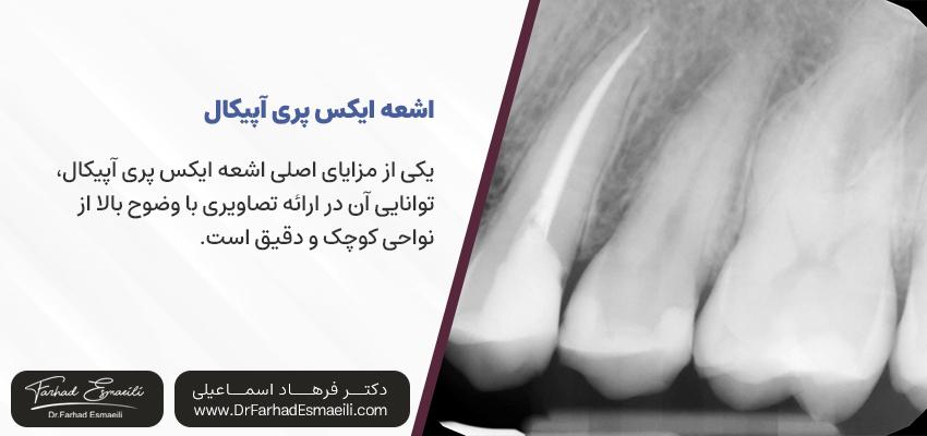 اشعه ایکس پری‌آپیکال در دندانپزشکی | دکتر فرهاد اسماعیلی