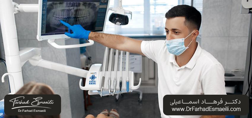 شرایط مناسب برای استفاده از ایمپلنت ساب پریوستئال | دکتر فرهاد اسماعیلی