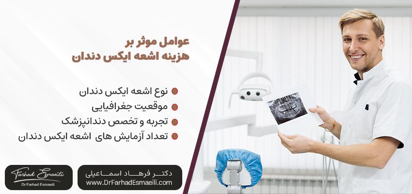 هزینه استفاده از اشعه اکس دندان | دکتر فرهاد اسماعیلی