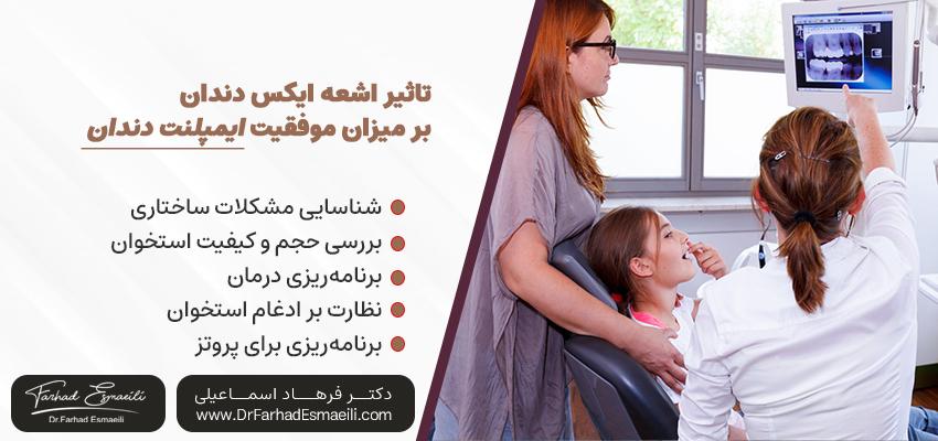 چگونه اشعه ایکس دندان می‌تواند میزان موفقیت ایمپلنت‌های دندانی را افزایش دهد؟ | دکتر فرهاد اسماعیلی در اصفهان