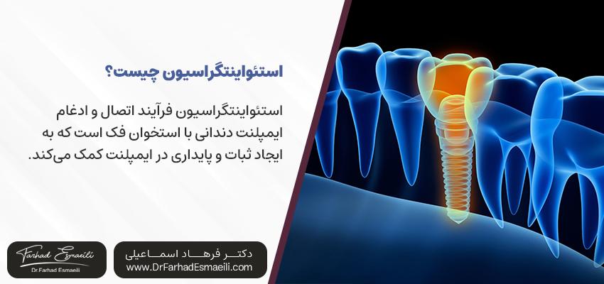 استئواینتگراسیون ایمپلنت دندان چیست؟ | دکتر فرهاد اسماعیلی