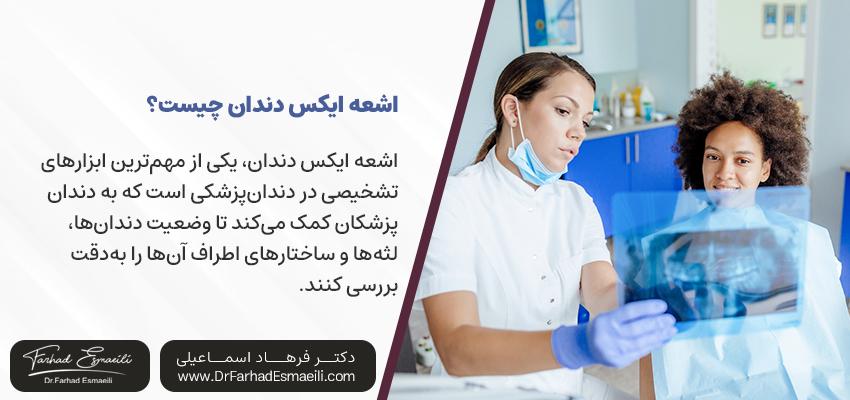 اشعه ایکس دندان چیست؟ | دکتر فرهاد اسماعیلی
