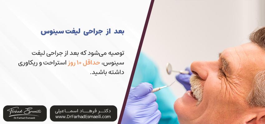 بعد از جراحی لیفت سینوس چه انتظاری باید داشته باشم؟ | دکتر فرهاد اسماعیلی