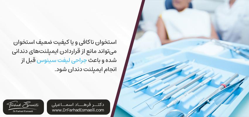 چه زمانی لیفت سینوس لازم است؟ | مطب دکتر فرهاد اسماعیلی در اصفهان