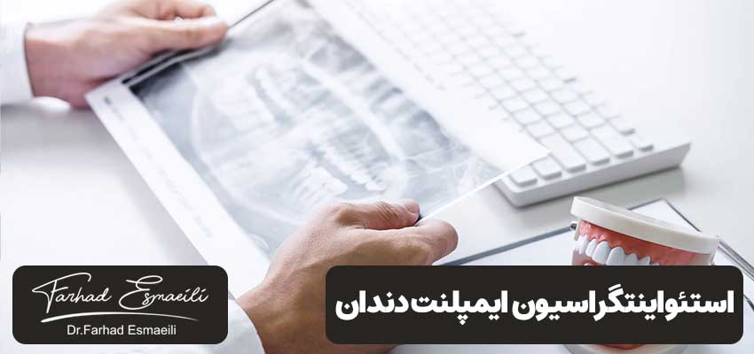 استئواینتگراسیون در ایمپلنت دندان: تعریف، مزایا و فرآیندها | مطب دکتر فرهاد اسماعیلی در اصفهان
