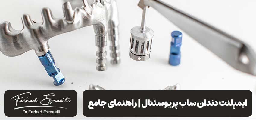 ایمپلنت دندان ساب پریوستئال | راهنمای جامع | دکتر فرهاد اسماعیلی