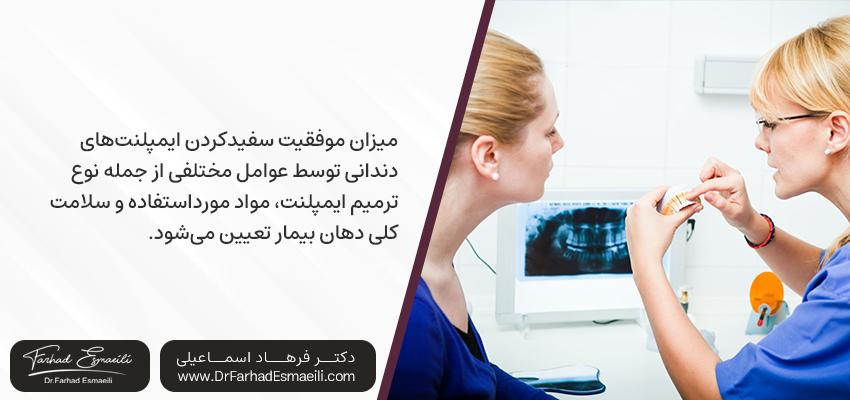 روش های سفید کردن ایمپلنت دندان | دکتر فرهاد اسماعیلی در اصفهان
