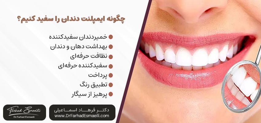 چگونه ایمپلنت دندان را سفید کنیم؟ | دکتر فرهاد اسماعیلی