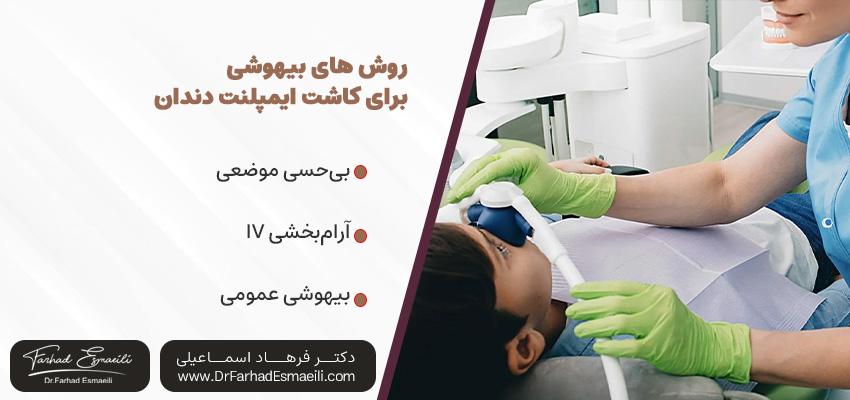 روش های بیهوشی و آرام بخشی برای کاشت ایمپلنت دندان | مطب ایمپلنت دیجیتال اصفهان
