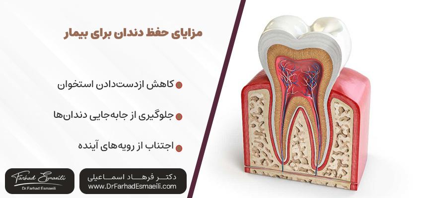 مزایای حفظ دندان برای بیمار | مطب ایمپلنت دیجیتال اصفهان