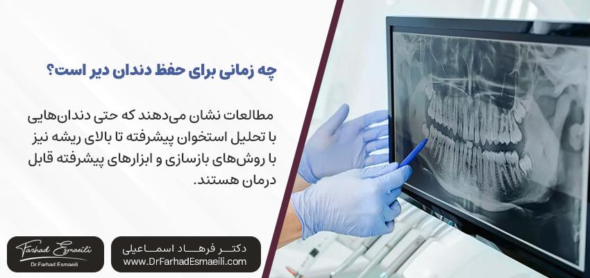 چه زمانی برای حفظ کردن دندان دیر است؟ | مطب ایمپلنت دیجیتال اصفهان