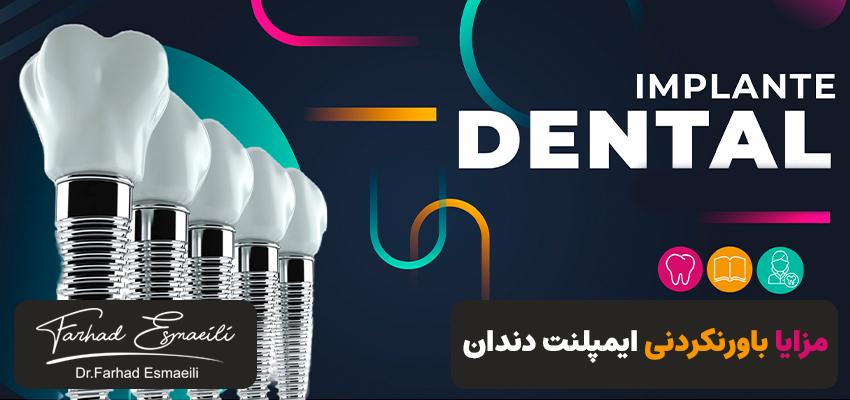 مزایا باورنکردنی ایمپلنت دندان | دکتر فرهاد اسماعیلی