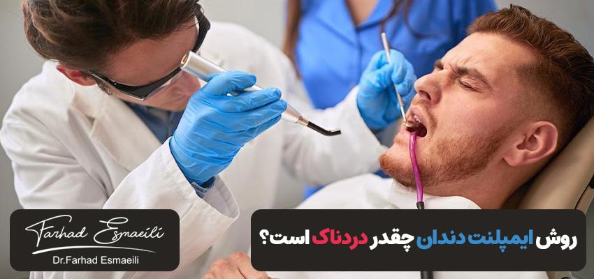 روش کاشت دندان چقدر دردناک است؟ | دکتر فرهاد اسماعیلی در اصفهان