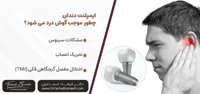 ایمپلنت دندان چطور موجب گوش درد می شود؟ | دکتر فرهاد اسماعیلی در اصفهان