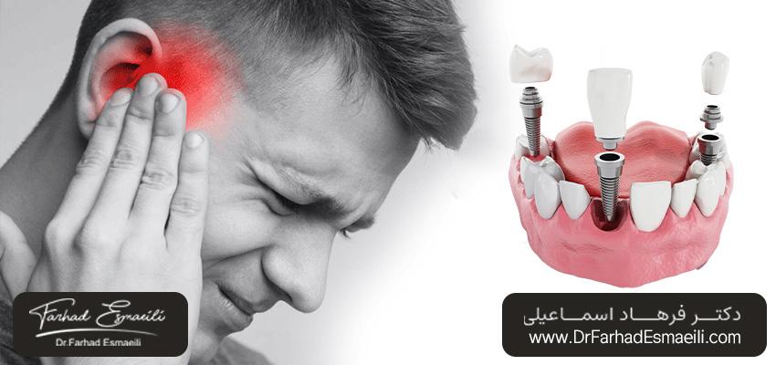 درمان وزوز گوش پس از جراحی ایمپلنت دندان | دکتر فرهاد اسماعیلی در اصفهان