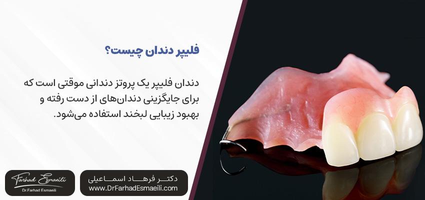 فلیپر دندان چیست؟ | دکتر فرهاد اسماعیلی در اصفهان