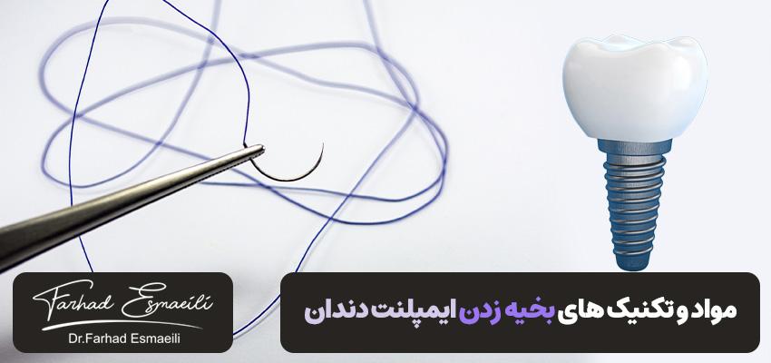 مواد و تکنیک های بخیه زدن در جراحی ایمپلنت دندان | دکتر فرهاد اسماعیلی