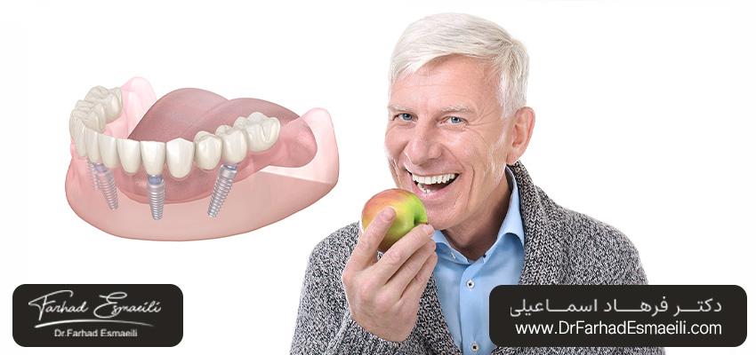 تبدیل دست دندان متحرک به پروتز ثابت با استفاده از ایمپلنت دندان All-on-4 | دکتر فرهاد اسماعیلی