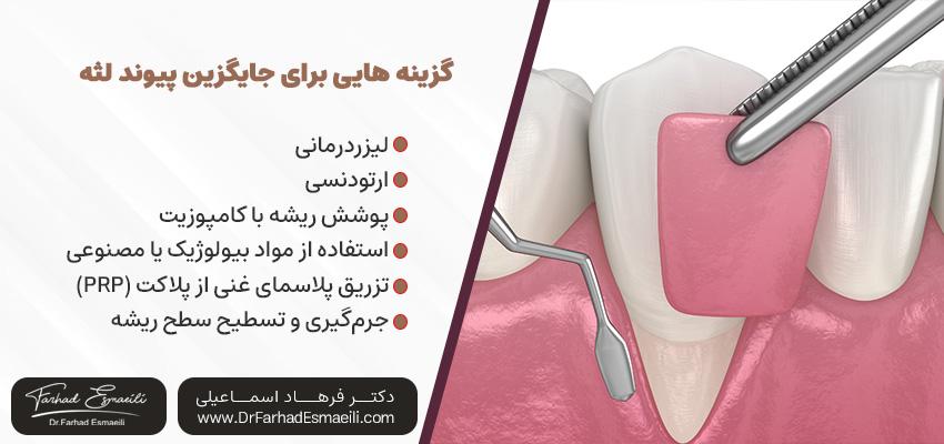 جایگزین پیوند لثه | دکتر فرهاد اسماعیلی