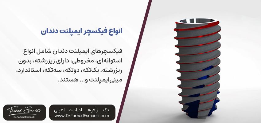 انواع فیکسچر ایمپلنت دندان | دکتر فرهاد اسماعیلی