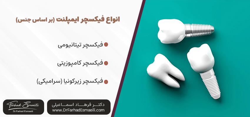 انواع فیکسچر ایمپلنت دندان | دکتر فرهاد اسماعیلی در اصفهان
