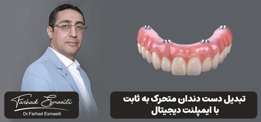 تبدیل دست دندان متحرک به ثابت با استفاده از ایمپلنت دیجیتال | دکتر فرهاد اسماعیلی