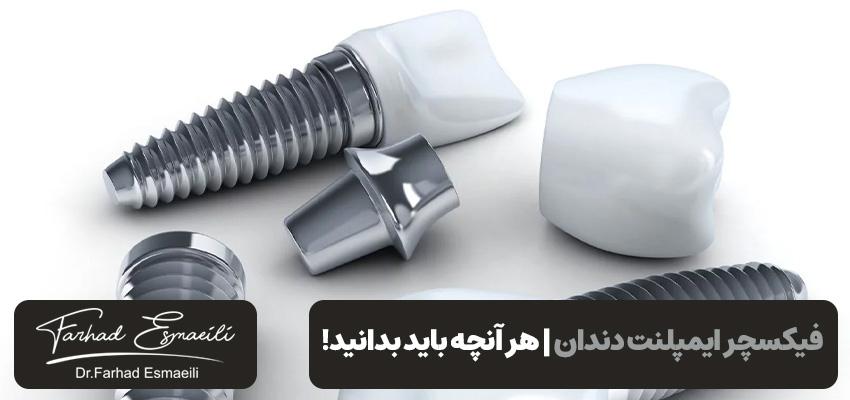 فیکسچر ایمپلنت دندان | هر آنچه باید بدانید! | دکتر فرهاد اسماعیلی
