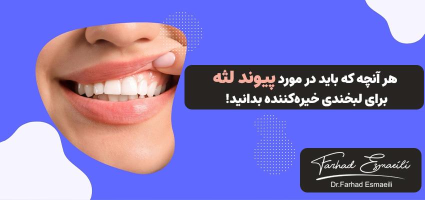 هر آنچه که باید در مورد ^پیوند لثه^ برای *لبخندی خیرهکننده* بدانید! | دکتر فرهاد اسماعیلی در اصفهان