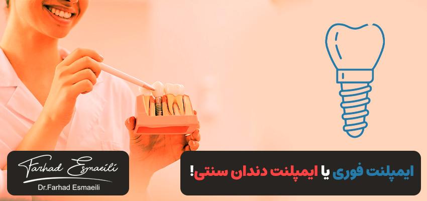 ایمپلنت فوری (سریعتر) یا ایمپلنت سنتی (مطمئنتر)! | دکتر فرهاد اسماعیلی در اصفهان