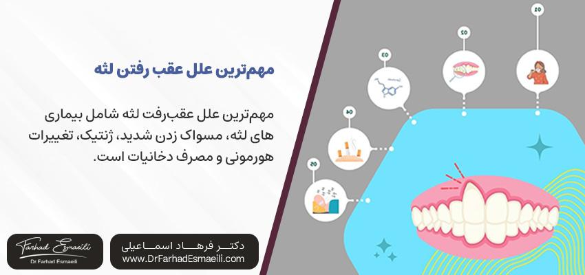 مهمترین علل عقب رفتن لثه | دکتر فرهاد اسماعیلی