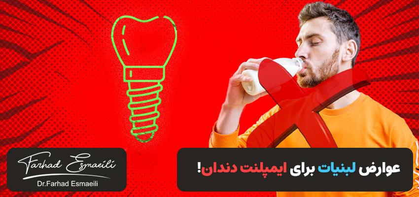عوارض لبنیات برای ایمپلنت دندان | باید بدانید! | دکتر فرهاد اسماعیلی در اصفهان