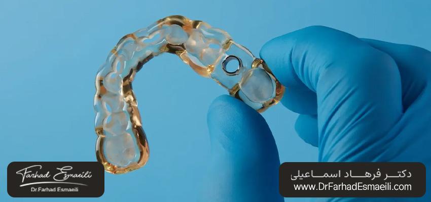 مزایای راهنمای جراحی ایمپلنت دندان | دکتر فرهاد اسماعیلی در اصفهان
