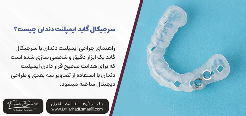 راهنمای جراحی ایمپلنت دندان چیست؟ | دکتر فرهاد اسماعیلی